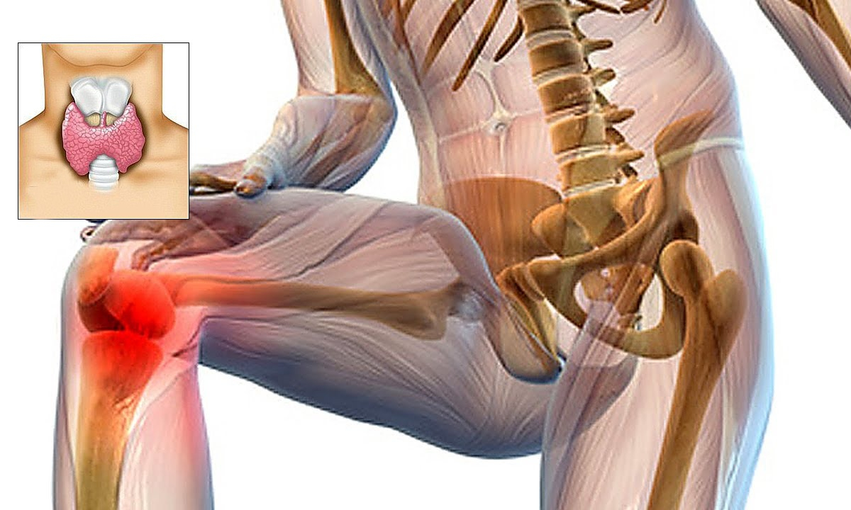 dureri la nivelul articulațiilor musculare